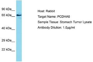 Host: Rabbit Target Name: PCDHA6 Sample Type: Stomach Tumor lysates Antibody Dilution: 1. (PCDHA6 anticorps  (N-Term))