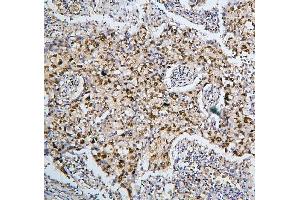 IHC analysis of PHF21A using anti-PHF21A antibody (ABIN6719353). (PHF21A anticorps  (AA 1-97))