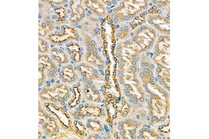 Immunohistochemistry of paraffin embedded mouse kidney using eIF5A2 (ABIN7073893) at dilution of 1:250 (400x lens) (EIF5A2 anticorps)