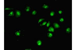 anti-DTW Domain Containing 1 (DTWD1) (AA 1-109) antibody