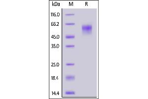 SARS-CoV-2 S1 protein NTD, His Tag on  under reducing (R) condition.