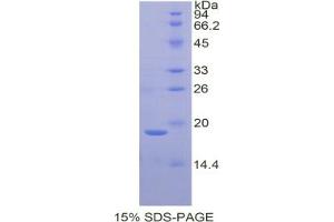 SDS-PAGE analysis of Rat Galectin 7 Protein. (LGALS7 Protéine)