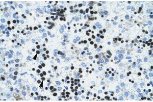 Human Liver; IVNS1ABP antibody - N-terminal region in Human Liver cells using Immunohistochemistry (IVNS1ABP anticorps  (N-Term))