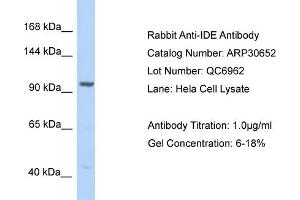 WB Suggested Anti-IDE Antibody   Titration: 1. (IDE anticorps  (N-Term))