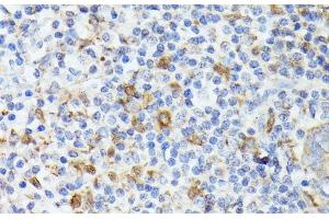 Immunohistochemistry of paraffin-embedded Human appendix using TIAL1 Polyclonal Antibody at dilution of 1:100 (40x lens).