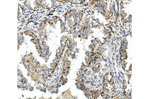 IHC analysis of Integrin beta 4/ITGB4 using anti-Integrin beta 4/ITGB4 antibody (ABIN7601135). (Integrin beta 4 anticorps  (AA 29-431))