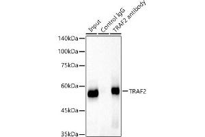 Immunoprecipitation analysis of 300 μg extracts of HeLa cells using 3 μg TR antibody .