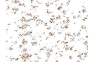 Immunocytochemistry (ICC) image for anti-Doublecortin (DCX) (AA 200-250) antibody (ABIN7453969)