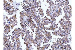 IHC analysis of HAX1 using anti-HAX1 antibody (ABIN7599208).