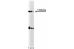 Western blot analysis of BMPR-II on mouse cerebrum lysate.