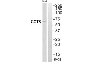 Western blot analysis of extracts from HeLa cells, using CCT8 antibody. (CCT8 anticorps  (Internal Region))