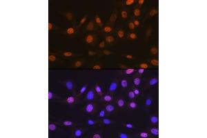 Immunofluorescence analysis of NIH-3T3 cells using T Rabbit mAb (ABIN7270729) at dilution of 1:100 (40x lens). (TARBP2 anticorps)