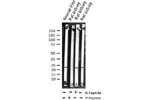Western blot analysis of Phospho-Caveolin-1 (Tyr14) expression in various lysates