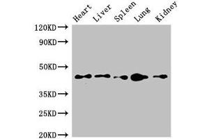 Western Blot Positive WB detected in: Mouse heart tissue, Mouse liver tissue, Mouse spleen tissue, Mouse lung tissue, Mouse kidney tissue All lanes: CD209 antibody at 4 μg/mL Secondary Goat polyclonal to rabbit IgG at 1/50000 dilution Predicted band size: 46, 36, 19, 44, 42, 31, 5, 38, 34 kDa Observed band size: 46 kDa (ITGB1 anticorps  (AA 297-380))