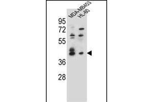 SOX3 Antibody (Center) (ABIN655392 and ABIN2844940) western blot analysis in MDA-M,HL-60 cell line lysates (35 μg/lane). (SOX3 anticorps  (AA 166-196))