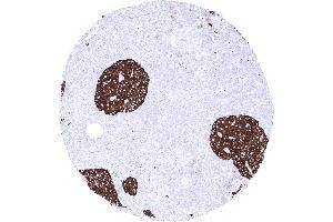 Pancreas A strong synaptophysin immunostaining is seen in islet cells of Langerhans (Recombinant Synaptophysin anticorps  (AA 274-313))