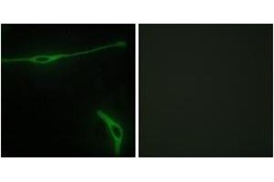 Immunofluorescence (IF) image for anti-Laminin, alpha 2 (LAMA2) (AA 2011-2060) antibody (ABIN2889999) (Laminin anticorps  (AA 2011-2060))