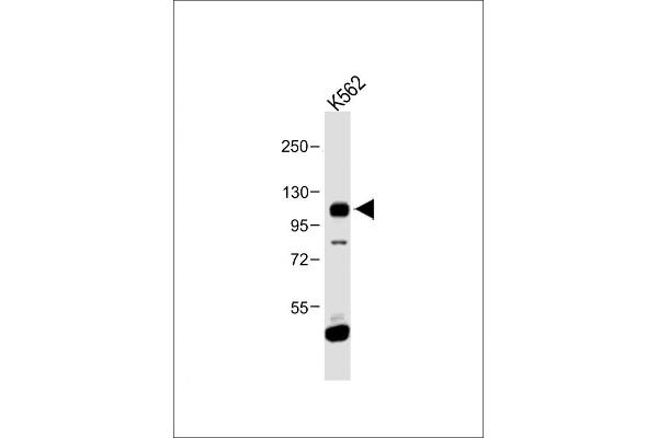 FGFR4 anticorps  (N-Term)