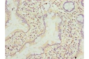 Immunohistochemistry of paraffin-embedded human small intestine tissue using ABIN7173167 at dilution of 1:100 (TMEM243 anticorps  (AA 1-31))