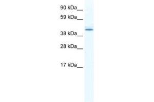 Western Blotting (WB) image for anti-DEAD (Asp-Glu-Ala-Asp) Box Polypeptide 49 (DDX49) antibody (ABIN2461354)
