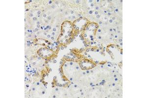 Immunohistochemistry of paraffin-embedded rat kidney using SH2B1 Antibody (ABIN5973245) at dilution of 1/100 (40x lens). (SH2B1 anticorps)