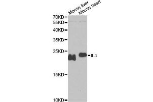 Western blot analysis of extracts of various cell lines, using IL3 antibody. (IL-3 anticorps)