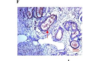 Expression of SPARC in human ovarian tissues using antibody AF941 and bs-1133R.