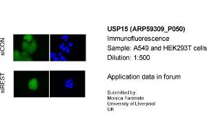 Immunofluorescence Sample Type: A549&HEK293T cellsPrimary Dilution: 1:500 (USP15 anticorps  (C-Term))