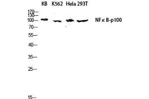 Western Blot (WB) analysis of KB K562 HeLa 293T lysis using NFkappaB-p100 antibody. (NFKB2 anticorps  (Thr160))