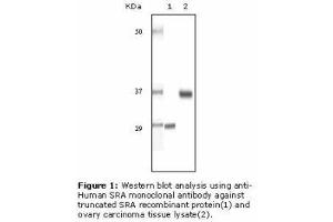 Image no. 2 for anti-Steroid Receptor RNA Activator 1 (SRA1) antibody (ABIN232100) (SRA1 anticorps)