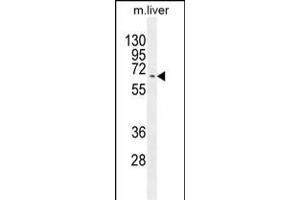Western blot analysis in mouse liver tissue lysates (35ug/lane). (Kyphoscoliosis Peptidase anticorps  (N-Term))