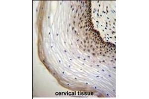 NU Antibody (Center) (ABIN655732 and ABIN2845179) immunohistochemistry analysis in formalin fixed and paraffin embedded human cervical tissue followed by peroxidase conjugation of the secondary antibody and DAB staining.