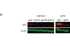 DCK mediates NUC-1031 sensitivity in pancreatic and ovarian cancer cells.