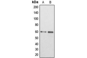 Western blot analysis of DAB1 expression in MCF7 (A), HEK293T (B) whole cell lysates.