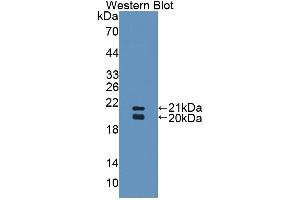 WB of Protein Standard: different control antibodies  against Highly purified E.