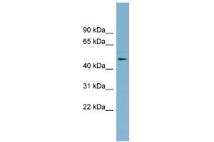WB Suggested Anti-TMLHE Antibody Titration: 0. (TMLHE anticorps  (Middle Region))