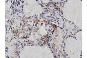 Immunohistochemical staining of paraffin-embedded Human liver tissue using anti-PECR mouse monoclonal antibody. (PECR anticorps)