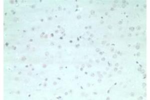 anti-rho GTPase Activating Protein 20 (ARHGAP20) (AA 570-620) antibody