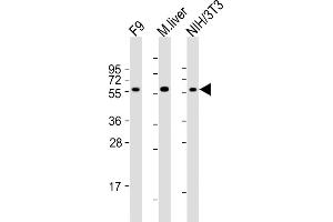 All lanes : Anti-Foxh1 Antibody (C-term) at 1:2000 dilution Lane 1: F9 whole cell lysates Lane 2: mouse liver lysates Lane 3: NIH/3T3 whole cell lysates Lysates/proteins at 20 μg per lane. (FOXH1 anticorps  (C-Term))