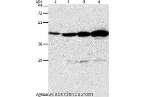 Western blot analysis of Mouse thymus tissue and A549 cell, Lovo and K562 cell, using APOBEC3D Polyclonal Antibody at dilution of 1:580 (APOBEC3D anticorps)