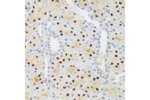Immunohistochemistry of paraffin-embedded rat kidney using STAT4 antibody. (STAT4 anticorps)