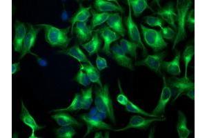 Immunofluorescent staining of HeLa cells using anti-TUBB4 mouse monoclonal antibody (ABIN2454621). (TUBB4 anticorps)