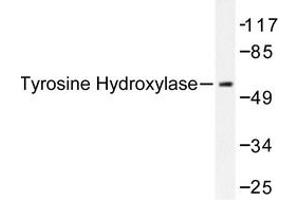 Image no. 1 for anti-Tyrosine Hydroxylase (TH) antibody (ABIN272085)