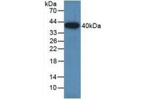 Detection of Recombinant GAP43, Rat using Polyclonal Antibody to Growth Associated Protein 43 (GAP43) (GAP43 anticorps  (AA 8-226))