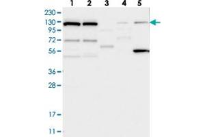 Western blot analysis of Lane 1: RT-4, Lane 2: U-251 MG, Lane 3: Human Plasma, Lane 4: Liver, Lane 5: Tonsil with DNAJC6 polyclonal antibody  at 1:250-1:500 dilution. (DNAJC6 anticorps)