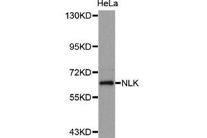 Western Blotting (WB) image for anti-Nemo-Like Kinase (NLK) antibody (ABIN1873910) (Nemo-Like Kinase anticorps)