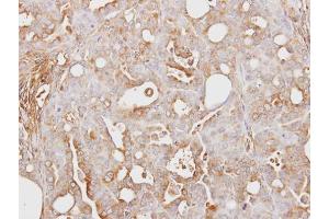 IHC-P Image Immunohistochemical analysis of paraffin-embedded NCI-N87 xenograft, using ITI-H3, antibody at 1:100 dilution.