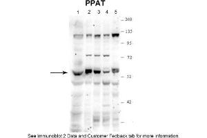Sample Type: 1. (PPAT anticorps  (N-Term))