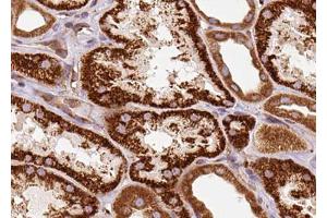 ABIN6272939 at 1/100 staining Human kidney tissue by IHC-P. (Centrin 1 anticorps  (Internal Region))