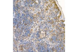Immunohistochemistry of paraffin-embedded mouse spleen using [KO Validated] RA Rabbit pAb (ABIN3021646, ABIN3021647, ABIN3021648 and ABIN1513457) at dilution of 1:100 (40x lens). (RAB5 anticorps  (AA 1-215))